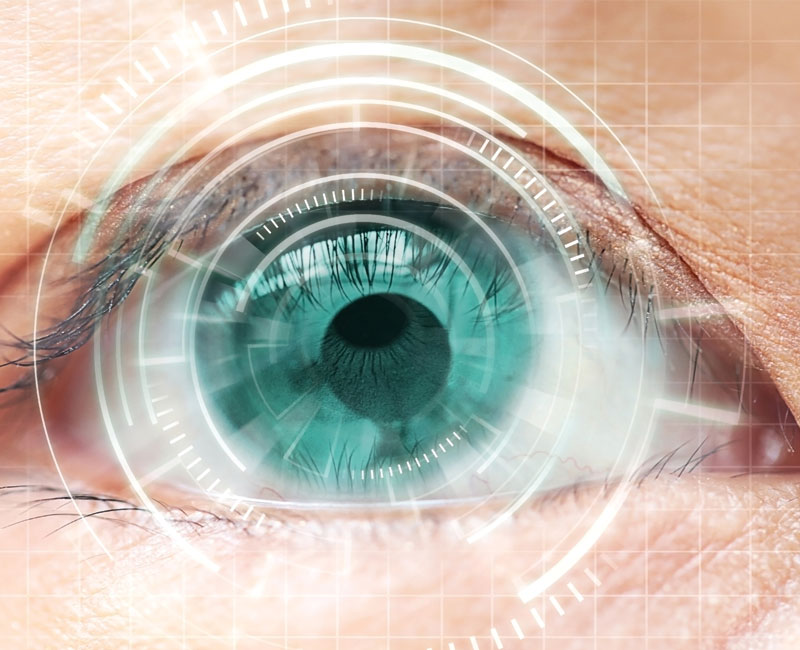 lasik